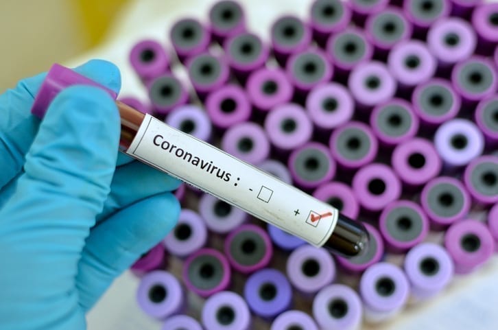 فيروس كورونا - Coronavirus